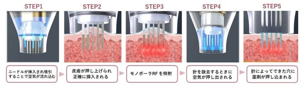 ドラッグデリバリーシステムについての解説図