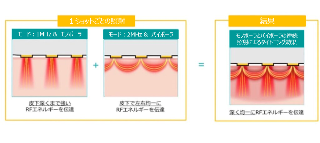 ダイヤモンドチップの照射方法についての説明ず