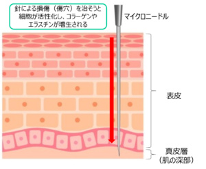 創傷治癒効果についての説明画像