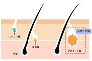 ワキガや匂いの原因の解説