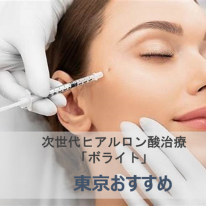 ボライトを打つ女性